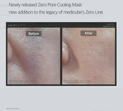 MEDICUBE Zero Pore Cooling Mask